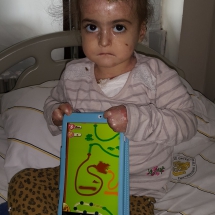 İrem-Taban-6-yaşında-bir-kelebek-Diyarbakırın-Ergani-ilçesinde-yaşıyor-kapalı-olan-el-parmakları-ameliyatla-açıldı